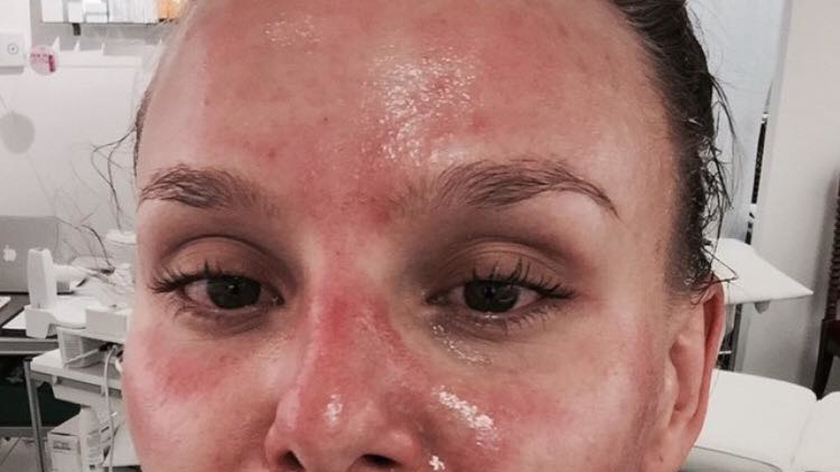Nicole Rydén på ansiktsbehandling.